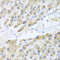 Immunohistochemistry of paraffin-embedded Human liver using CCL3 Polyclonal Antibody at dilution of 1:100 (40x lens) .