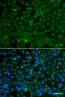 Immunofluorescence analysis of A549 cells using WDR45 Polyclonal Antibody