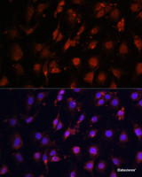 Immunofluorescence analysis of C6 cells using TET3 Polyclonal Antibody at dilution of 1:100. Blue: DAPI for nuclear staining.