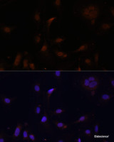 Immunofluorescence analysis of U2OS cells using TET3 Polyclonal Antibody at dilution of 1:100. Blue: DAPI for nuclear staining.