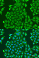 Immunofluorescence analysis of U2OS cells using CENPK Polyclonal Antibody at dilution of 1:100. Blue: DAPI for nuclear staining.