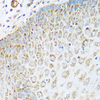 Immunohistochemistry of paraffin-embedded Human esophagus using GLUD1 Polyclonal Antibody at dilution of 1:100 (40x lens) .