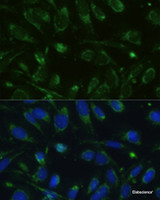 Immunofluorescence analysis of U-2 OS cells using GLUD1 Polyclonal Antibody at dilution of 1:100. Blue: DAPI for nuclear staining.