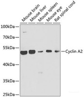 Western blot analysis of extracts of various cell lines using Cyclin A2 Polyclonal Antibody at dilution of 1:1000.