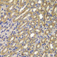 Immunohistochemistry of paraffin-embedded Mouse kidney using Cyclin A2 Polyclonal Antibody at dilution of 1:100 (40x lens) .