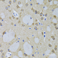 Immunohistochemistry of paraffin-embedded Mouse brain using YWHAZ Polyclonal Antibody at dilution of 1:100 (40x lens) .