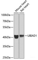 Western blot analysis of extracts of various cell lines using UBIAD1 Polyclonal Antibody at dilution of 1:1000.