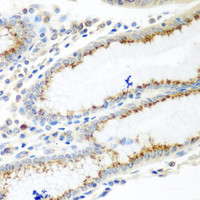 Immunohistochemistry of paraffin-embedded Human stomach using UBIAD1 Polyclonal Antibody at dilution of 1:100 (40x lens) .