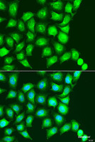 Immunofluorescence analysis of U2OS cells using UBIAD1 Polyclonal Antibody at dilution of 1:100. Blue: DAPI for nuclear staining.