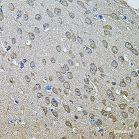 Immunohistochemistry of paraffin-embedded Mouse brain using ANXA8L2 Polyclonal Antibody at dilution of 1:100 (40x lens) .