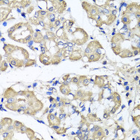 Immunohistochemistry of paraffin-embedded Human stomach using BCS1L Polyclonal Antibody at dilution of 1:100 (40x lens) .
