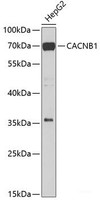 Western blot analysis of extracts of HepG2 cells using CACNB1 Polyclonal Antibody at dilution of 1:1000.