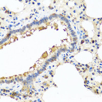 Immunohistochemistry of paraffin-embedded Rat lung using CHI3L2 Polyclonal Antibody at dilution of 1:100 (40x lens) .