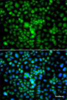 Immunofluorescence analysis of A549 cells using CIDEA Polyclonal Antibody