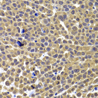 Immunohistochemistry of paraffin-embedded Mouse lung cancer using ARID3A Polyclonal Antibody at dilution of 1:100 (40x lens) .