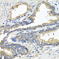 Immunohistochemistry of paraffin-embedded Human prostate using ETFA Polyclonal Antibody at dilution of 1:100 (40x lens) .