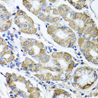 Immunohistochemistry of paraffin-embedded Human stomach using ETFA Polyclonal Antibody at dilution of 1:100 (40x lens) .