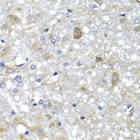 Immunohistochemistry of paraffin-embedded Rat brain using ETFA Polyclonal Antibody at dilution of 1:100 (40x lens) .