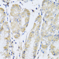 Immunohistochemistry of paraffin-embedded Human stomach using FANCA Polyclonal Antibody at dilution of 1:100 (40x lens) .