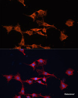 Immunofluorescence analysis of C6 cells using GSTM3 Polyclonal Antibody at dilution of 1:100. Blue: DAPI for nuclear staining.