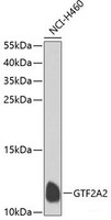 Western blot analysis of extracts of NCI-H460 cells using GTF2A2 Polyclonal Antibody at dilution of 1:1000.
