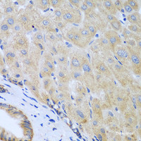 Immunohistochemistry of paraffin-embedded Human liver using IL5 Polyclonal Antibody at dilution of 1:100 (40x lens) .