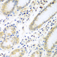 Immunohistochemistry of paraffin-embedded Human stomach using IL5 Polyclonal Antibody at dilution of 1:100 (40x lens) .