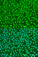 Immunofluorescence analysis of U2OS cells using NBN Polyclonal Antibody at dilution of 1:100. Blue: DAPI for nuclear staining.