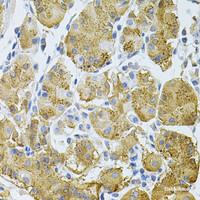 Immunohistochemistry of paraffin-embedded Human stomach using PLCG1 Polyclonal Antibody at dilution of 1:100 (40x lens) .