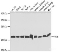 Western blot analysis of extracts of various cell lines using PPIB Polyclonal Antibody at dilution of 1:1000.