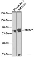 Western blot analysis of extracts of various cell lines using PPP3CC Polyclonal Antibody at dilution of 1:1000.