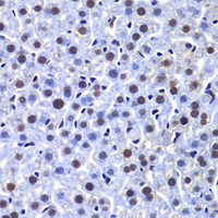 Immunohistochemistry of paraffin-embedded Mouse liver using PRKDC Polyclonal Antibody at dilution of 1:100 (40x lens) .
