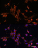 Immunofluorescence analysis of NIH/3T3 cells using MAP2K3 Polyclonal Antibody at dilution of 1:100. Blue: DAPI for nuclear staining.