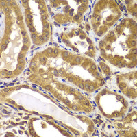 Immunohistochemistry of paraffin-embedded Human kidney using PSEN2 Polyclonal Antibody at dilution of 1:100 (40x lens) .