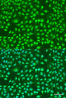 Immunofluorescence analysis of U2OS cells using PSEN2 Polyclonal Antibody at dilution of 1:100. Blue: DAPI for nuclear staining.