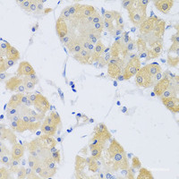 Immunohistochemistry of paraffin-embedded Human stomach using CLIP1 Polyclonal Antibody at dilution of 1:100 (40x lens) .