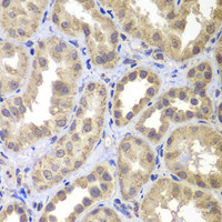 Immunohistochemistry of paraffin-embedded Human kidney using MAP2K4 Polyclonal Antibody at dilution of 1:100 (40x lens) .