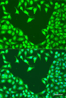 Immunofluorescence analysis of U2OS cells using MAP2K4 Polyclonal Antibody at dilution of 1:100. Blue: DAPI for nuclear staining.