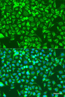 Immunofluorescence analysis of U2OS cells using SHC1 Polyclonal Antibody at dilution of 1:100. Blue: DAPI for nuclear staining.