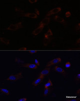 Immunofluorescence analysis of NIH-3T3 cells using SHH Polyclonal Antibody at dilution of 1:100 (40x lens) . Blue: DAPI for nuclear staining.