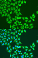 Immunofluorescence analysis of U2OS cells using STAT5A Polyclonal Antibody at dilution of 1:100. Blue: DAPI for nuclear staining.