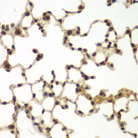 Immunohistochemistry of paraffin-embedded Mouse lung using SULT2B1 Polyclonal Antibody at dilution of 1:100 (40x lens) .