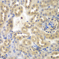 Immunohistochemistry of paraffin-embedded Mouse kidney using SULT2B1 Polyclonal Antibody at dilution of 1:100 (40x lens) .