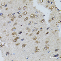 Immunohistochemistry of paraffin-embedded Rat brain using TRPC3 Polyclonal Antibody