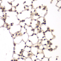 Immunohistochemistry of paraffin-embedded Rat lung using VRK1 Polyclonal Antibody at dilution of 1:100 (40x lens) .