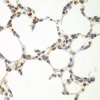 Immunohistochemistry of paraffin-embedded Mouse lung using VRK1 Polyclonal Antibody at dilution of 1:100 (40x lens) .