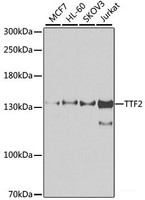 Western blot analysis of extracts of various cell lines using TTF2 Polyclonal Antibody at dilution of 1:1000.