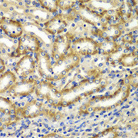 Immunohistochemistry of paraffin-embedded Mouse kidney using DGKE Polyclonal Antibody at dilution of 1:100 (40x lens) .