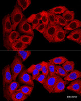 Confocal immunofluorescence analysis of U-2 OS cells using SQSTM1 / p62 Polyclonal Antibody at dilution of 1:200. Blue: DAPI for nuclear staining.