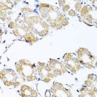 Immunohistochemistry of paraffin-embedded Human stomach using COQ7 Polyclonal Antibody at dilution of 1:100 (40x lens) .